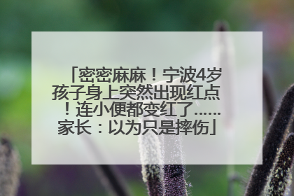 密密麻麻！宁波4岁孩子身上突然出现红点！连小便都变红了……家长：以为只是摔伤