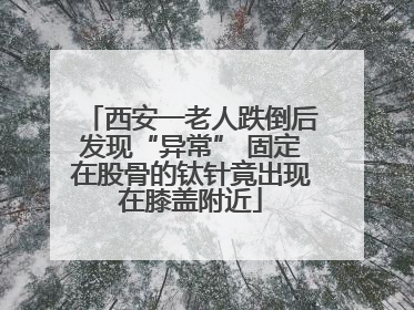 西安一老人跌倒后发现“异常” 固定在股骨的钛针竟出现在膝盖附近